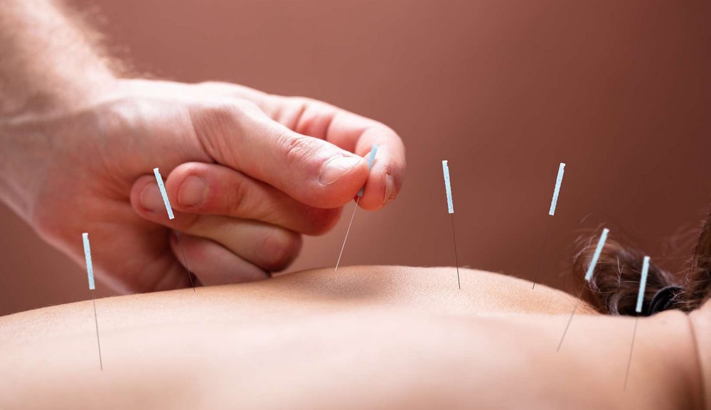 Ce que vous devez connaître sur l’acupuncture Ce que vous devez connaître sur l’acupuncture